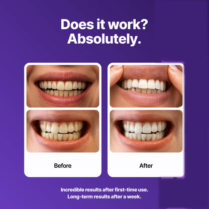 Purple Whitening Teeth Strips (42 Strips)